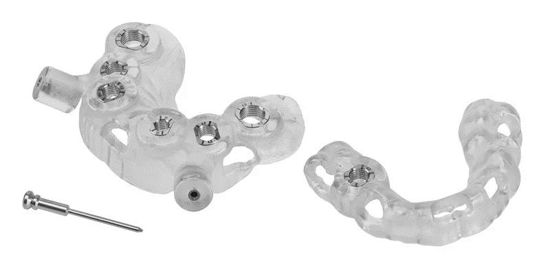 Імплантація  &laquo;All-on-6&raquo;